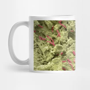 Pseudomonas lung infection, SEM (C021/7004) Mug